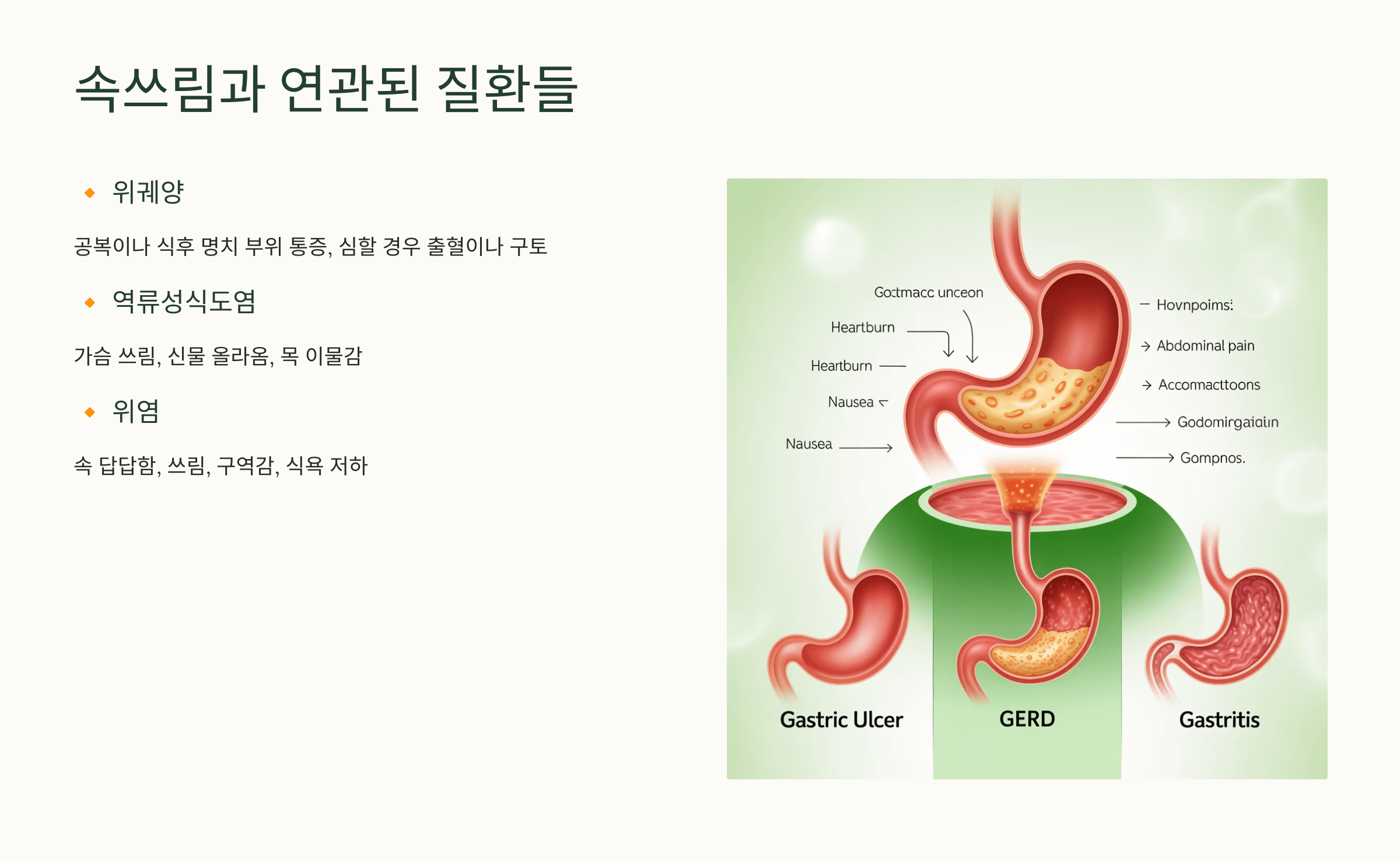 속쓰림 증상 사진입니다.