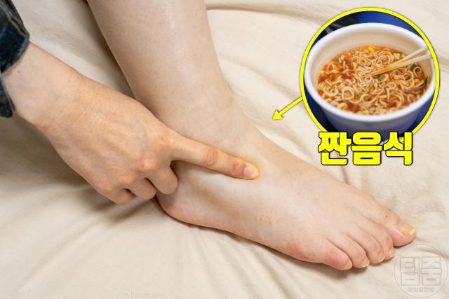 다리 양말자국 질환 코끼리다리 무다리 원인 부종 체액저류