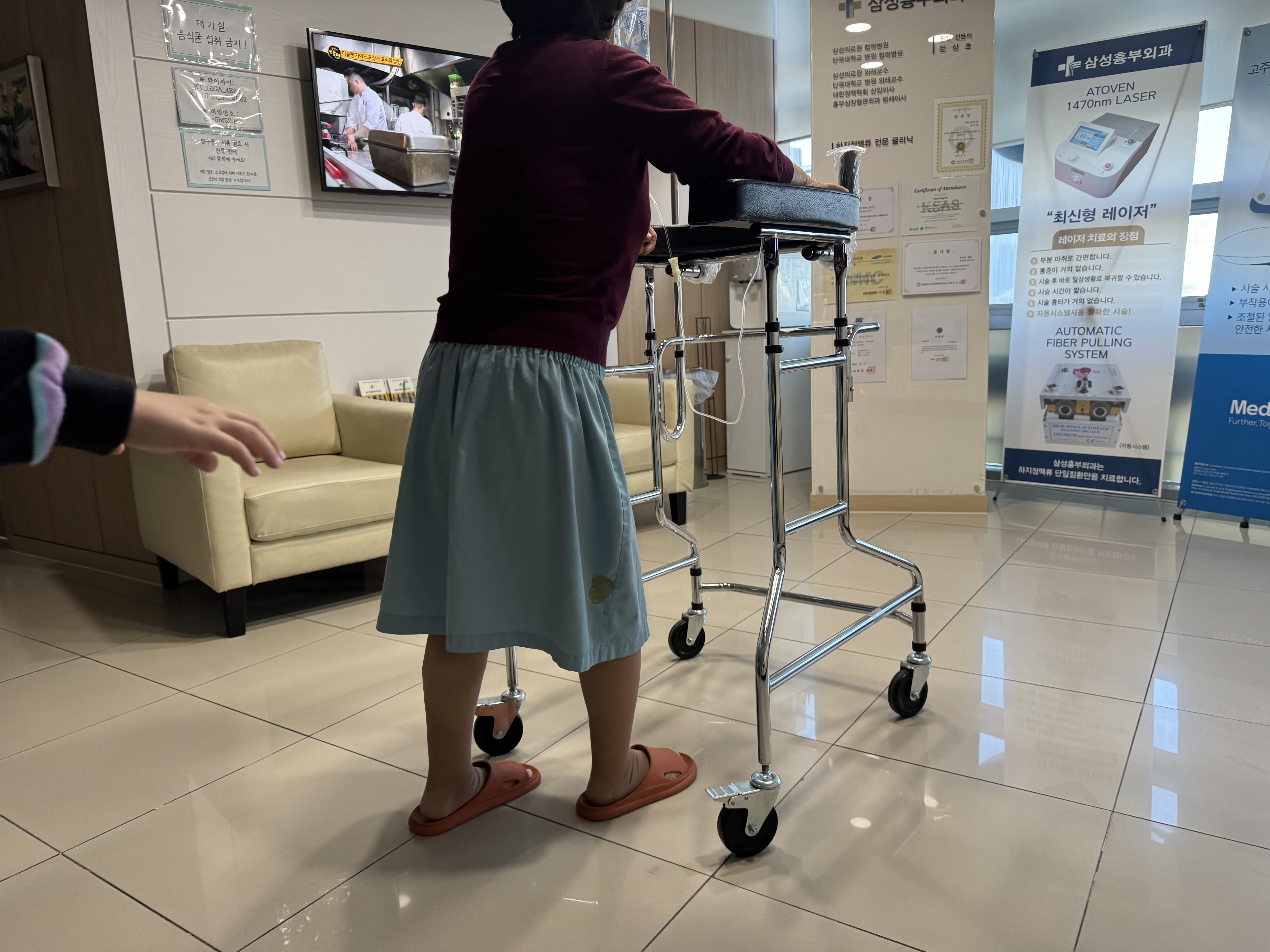 하지정맥류 수술 후기와 증상&middot;치료까지 한 번에 정리