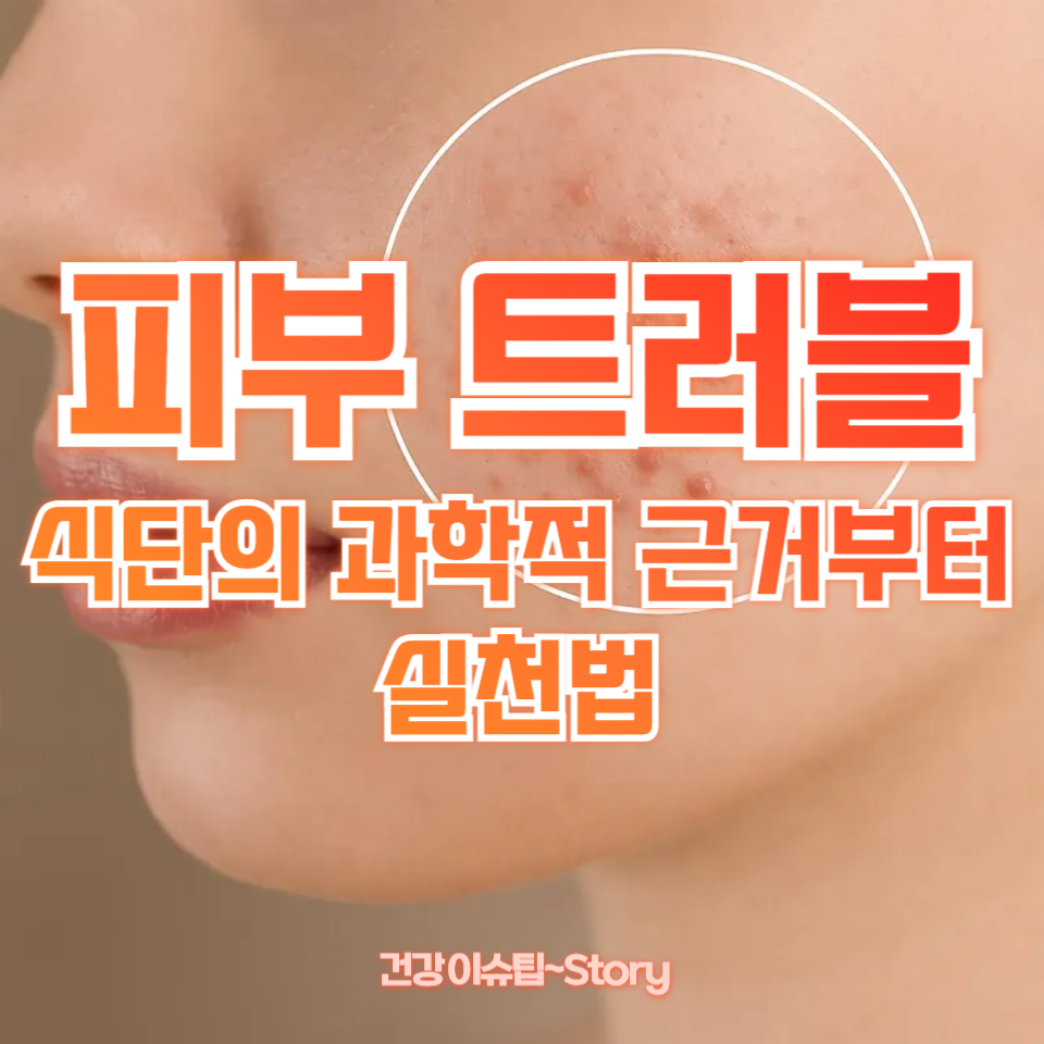 피부 트러블