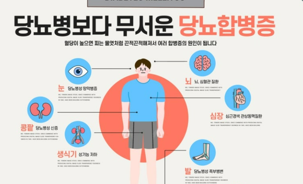 당뇨 합병증 설명