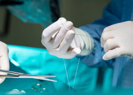 하지정맥류 수술