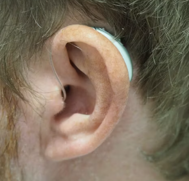 이명 치료법 진단 기준 합병증 관리