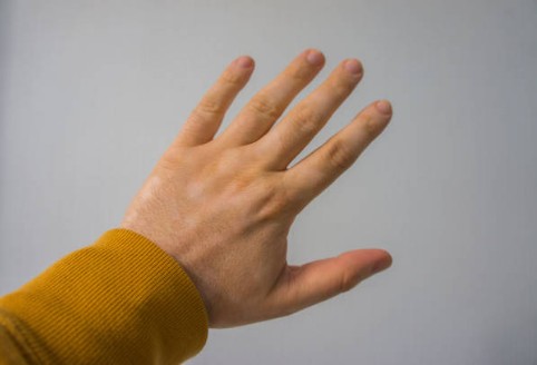 손등이 붓는 이유