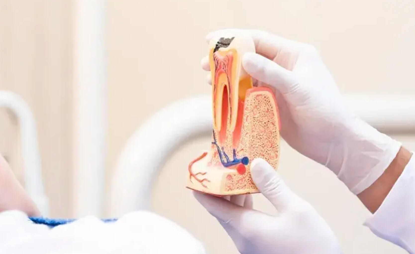 치근단절제술 비용