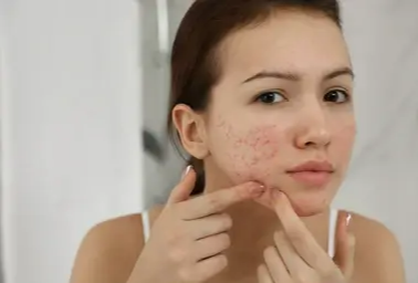 일상을 불편하게 하는 질환 관리