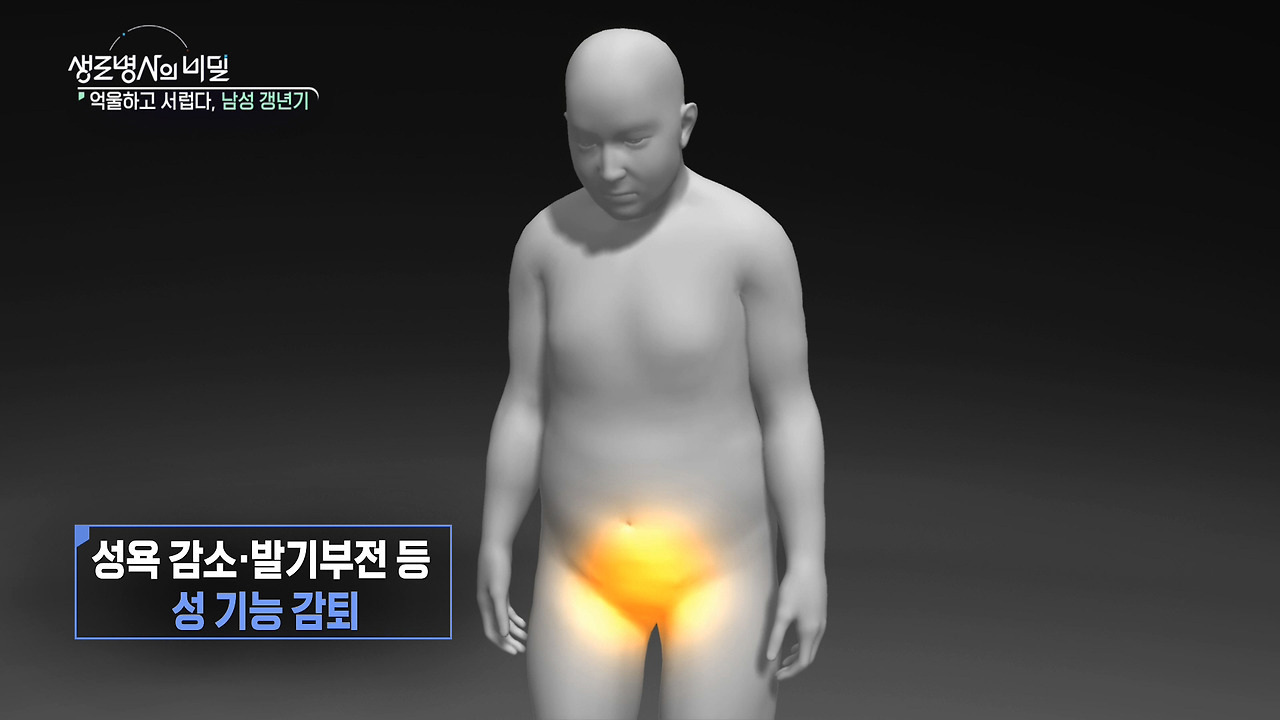 생로병사의 비밀 남성 갱년기