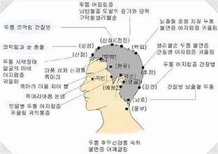 지압