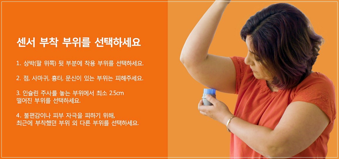 연속 혈당측정기