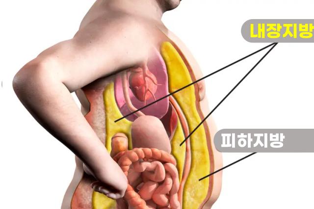 내장지방