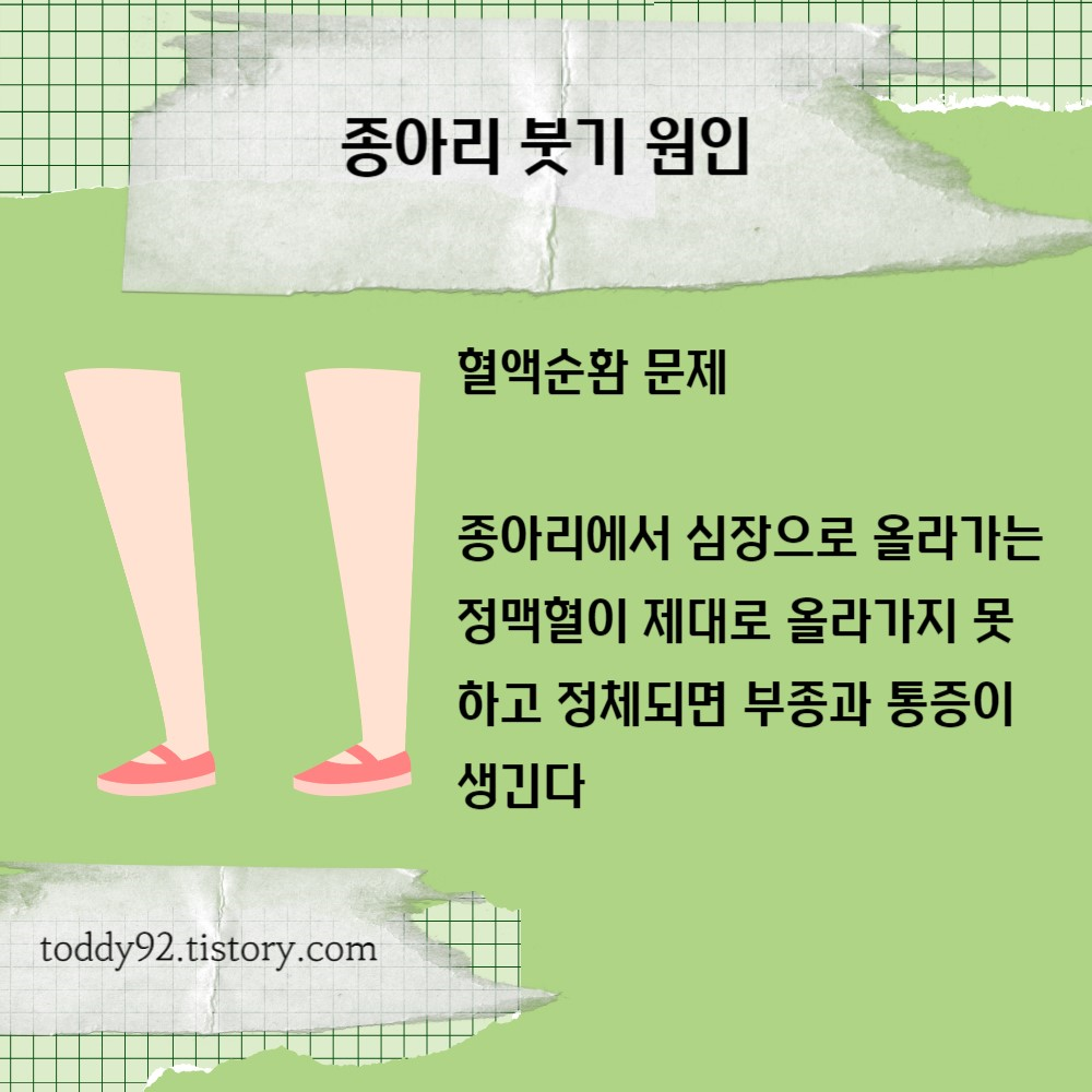 종아리 붓기 원인