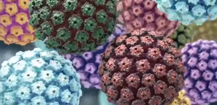 hpv 바이러스 증상