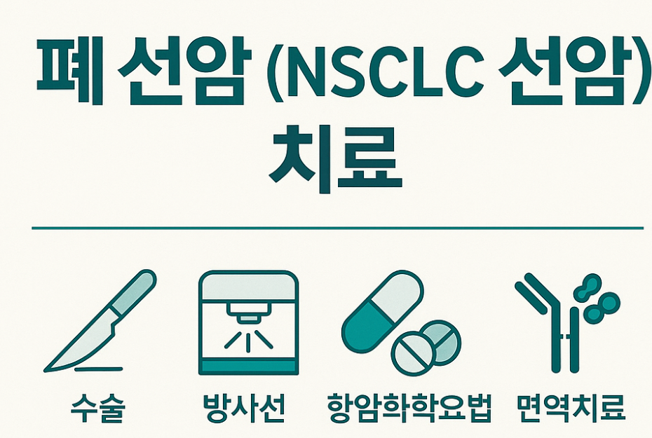 비소세포폐암(NSCLC) 치료 방법 15가지