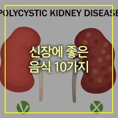 신장에 좋은 음식 10가지