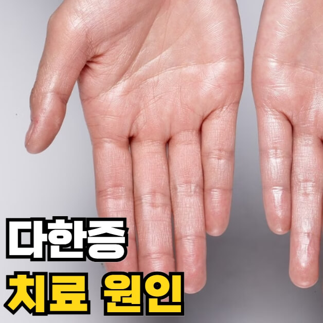 다한증 치료 원인