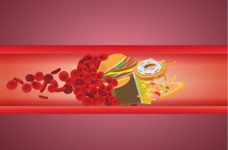 LDL 수치가 높을 때 위험성