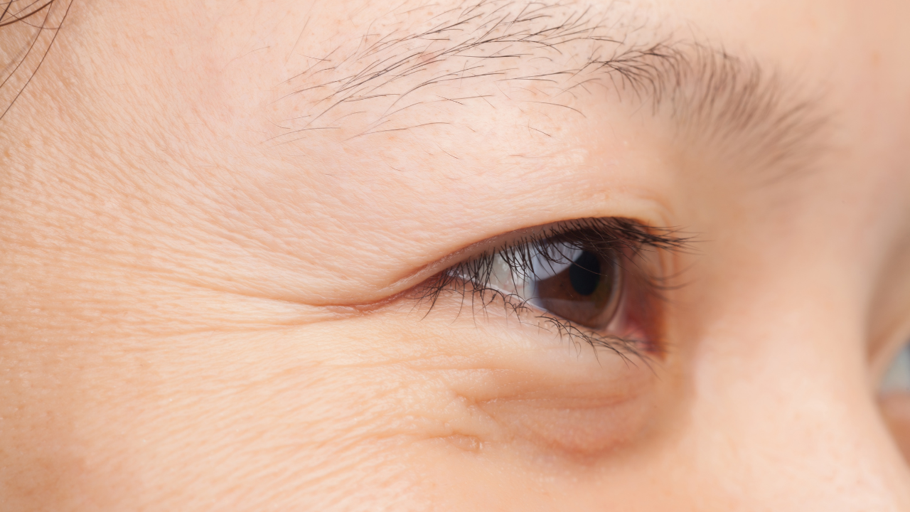 나이보다 젊어 보이는 비결! 주름개선에 도움이 되는 모든 것