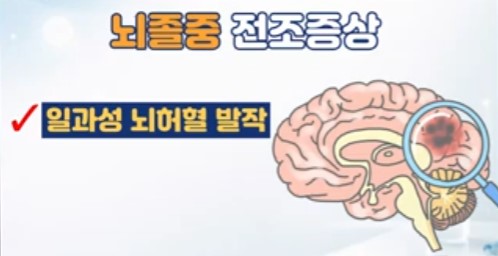 뇌졸증 전조증상