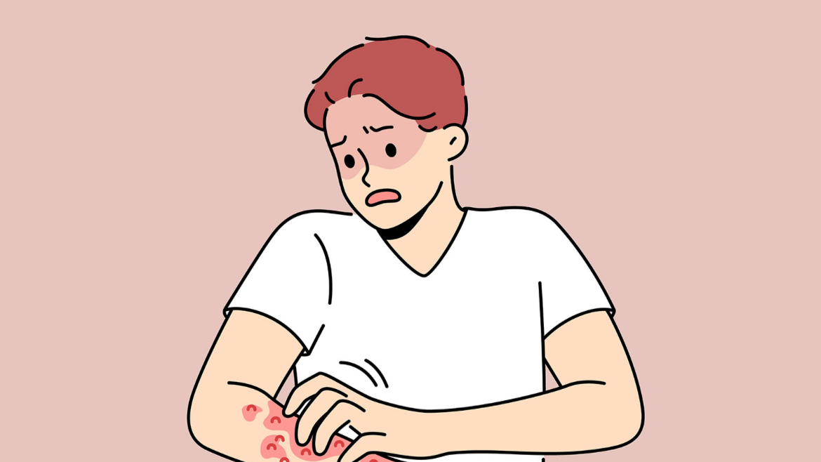 엠폭스-발생국가-발생원인