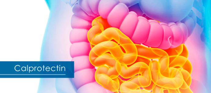 Calprotectin 수치와 임상적 의의