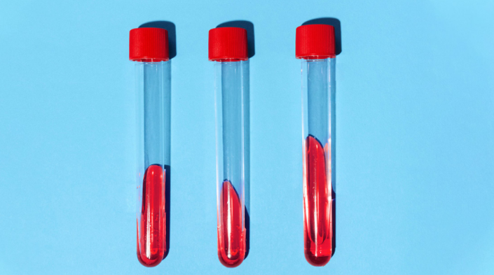 STD 12종 성병 검사