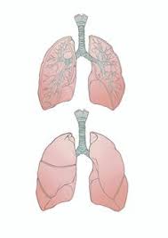 폐에 물이 차는 원인