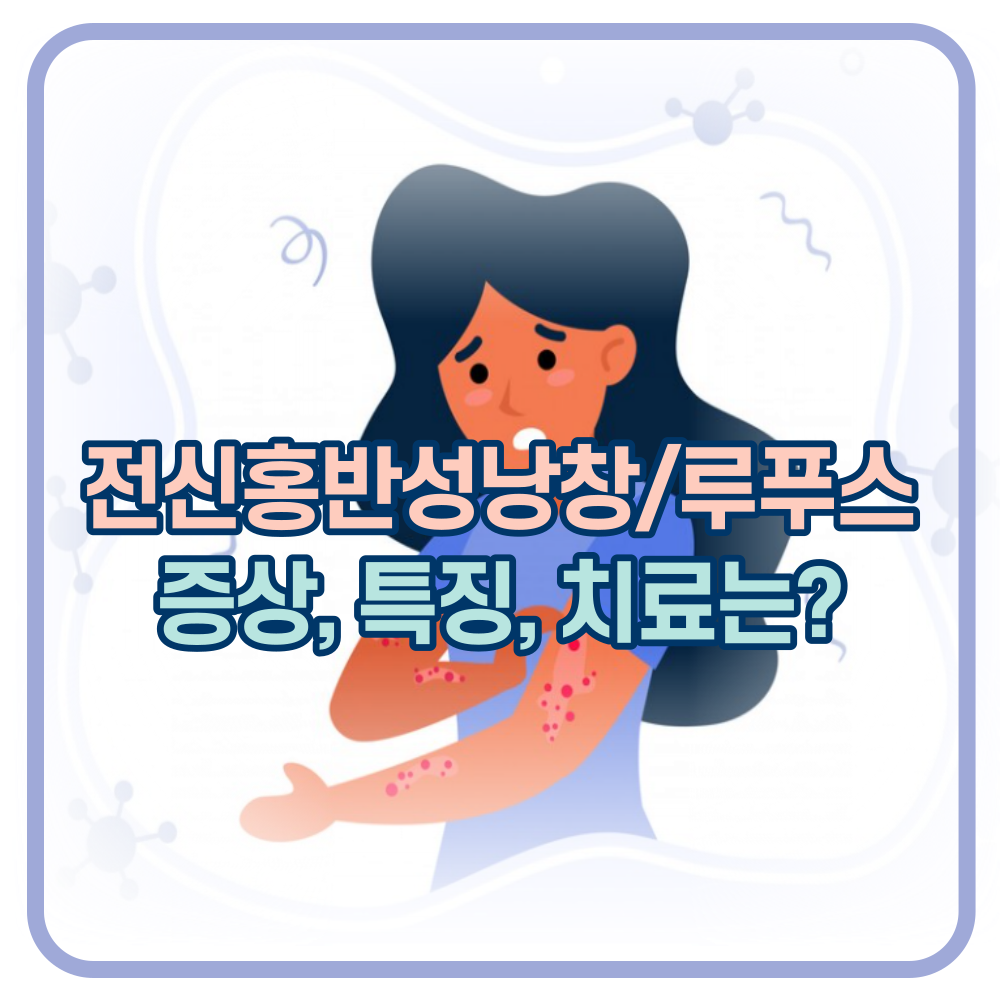 루푸스(전신홍반성낭창). 스테로이드 치료에 심하면 고관절 괴사까지?