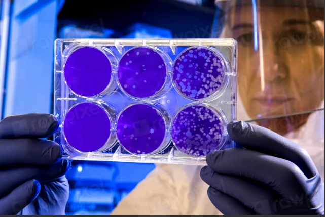 호흡기세포융합바이러스(RSV)