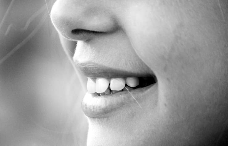 웃을때-하얀-치아