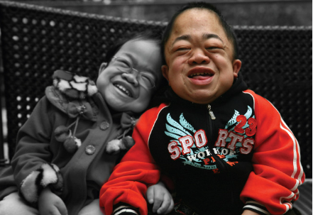 뮤코리피드증과 뮤코리지질증