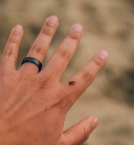 방아쇠 수지 증후군 치료