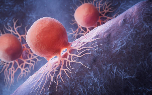 과탄산혈증(hypercapnia) 증상