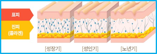 레티놀
