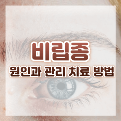 비립종 예방
비립종 스스로 제거해도 되나요?
비립종 관리법
비립종 레티놀
비립종 스팀 요법
비립종 피부과 제거
비립종 생기는 이유
비립종 없애는 방법
비립종 제거 집에서 제거