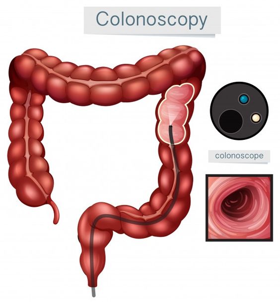colon