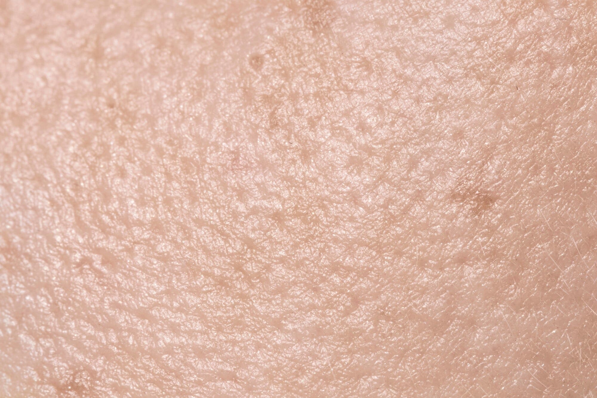 유방암 초기증상