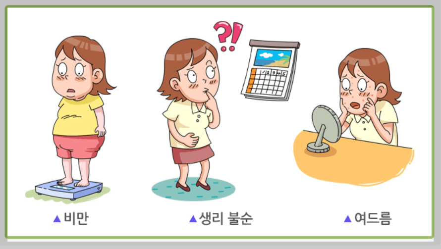 다낭성 난소증후군5