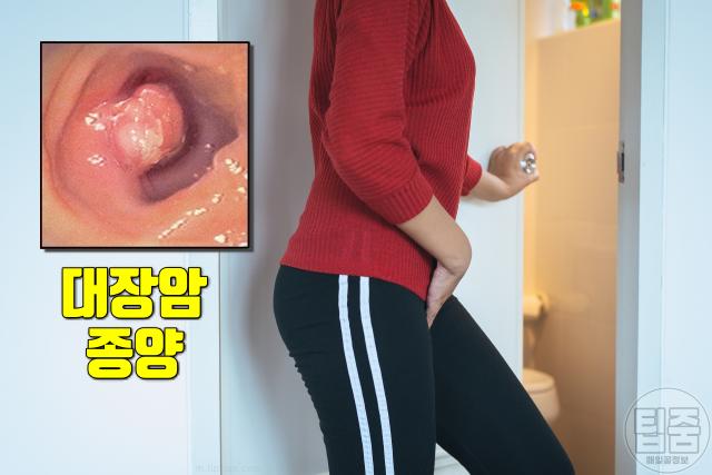 대장암 전조증상 4기 대장암증상 화장실 횟수