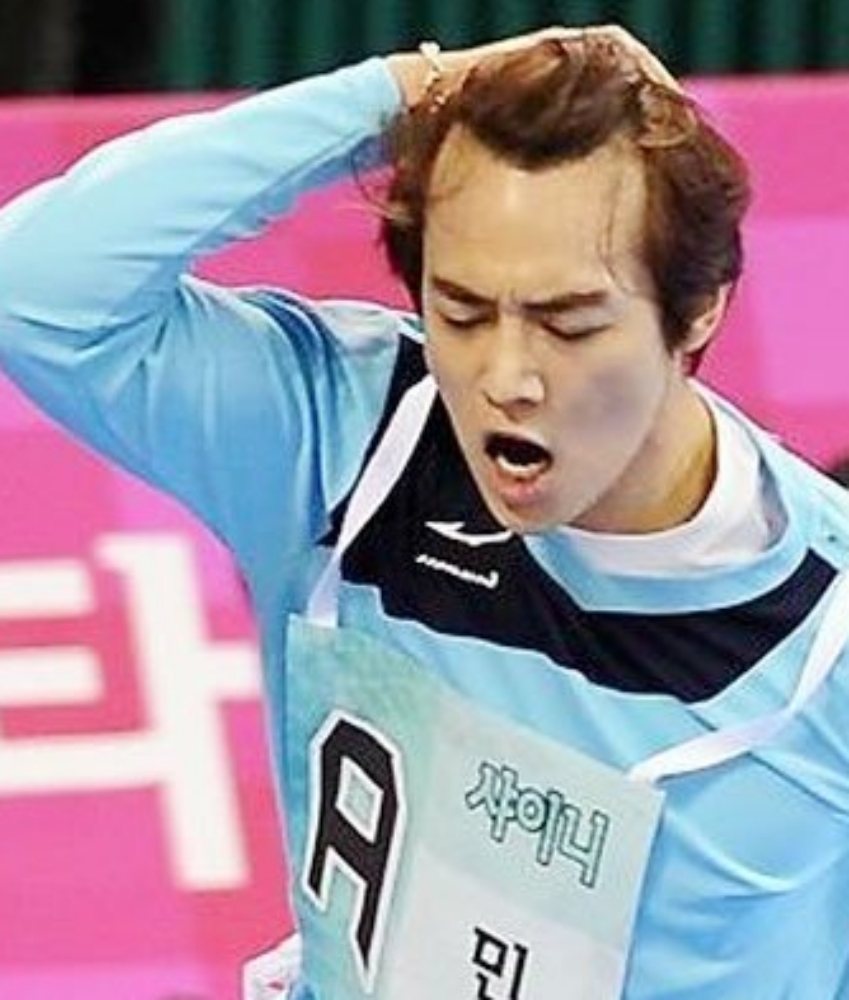 민호-탈모
