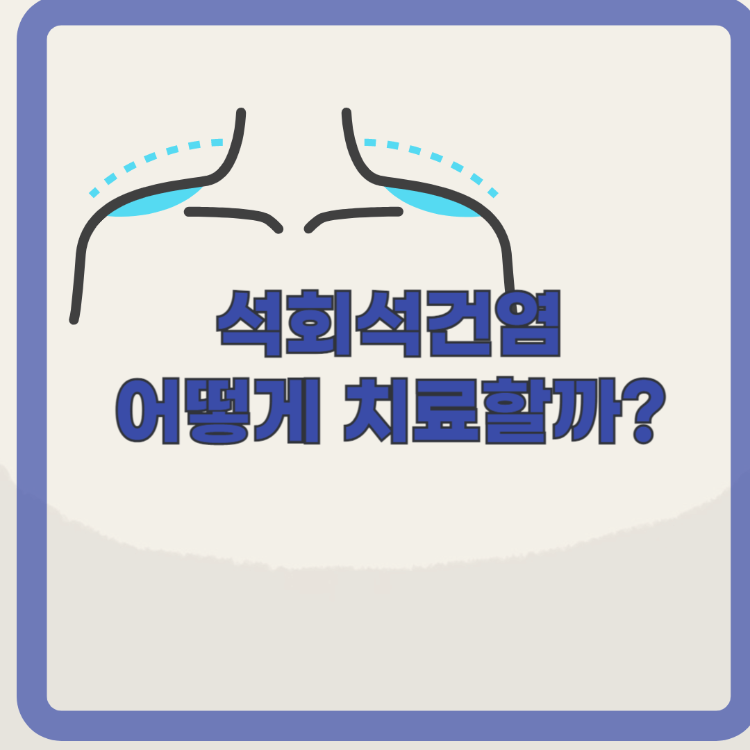 어깨에 돌이? 석회화건염의 증상과 치료 알아보기