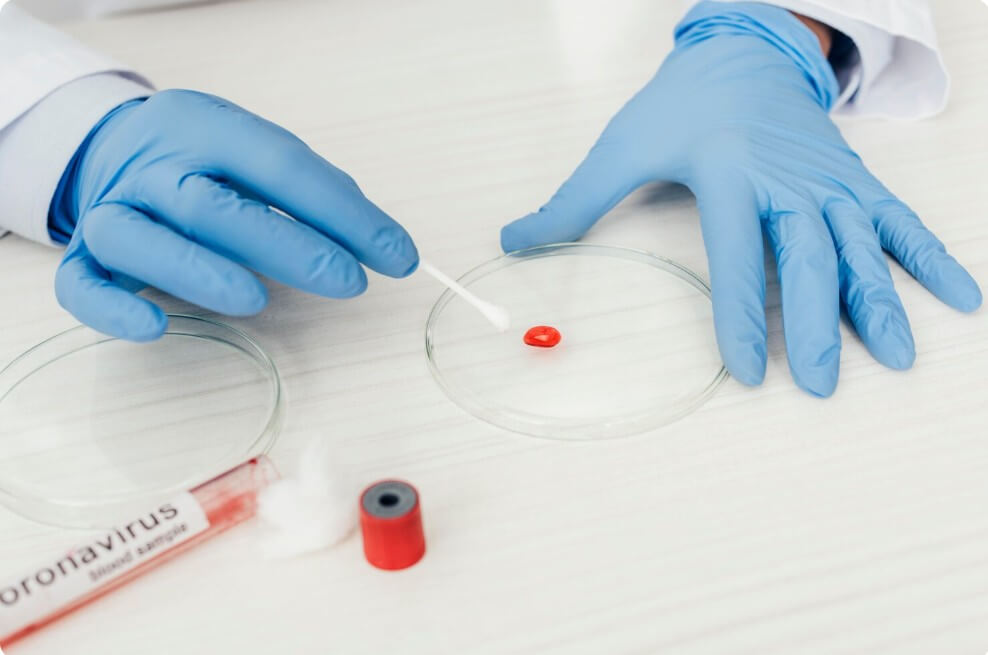 실험실에서 피에 대한 실험을 하는 모습