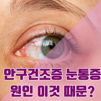 안구건조증 원인