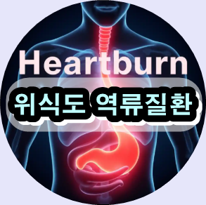 역류성 식도염 증상 완화 방법,
속쓰림 (소화불량) 자연 치료,
위식도 역류질환 예방 식습관,
위산 역류 원인과 치료법,
야간 역류성 식도염 대처법,
위식도 역류질환 자연 약초,
위식도 괄약근 강화 운동,
위식도 역류질환 식이요법,
속쓰림 피해야 할 음식,
역류성 식도염 재발 방지 팁,