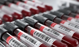 당화혈색소-사진8