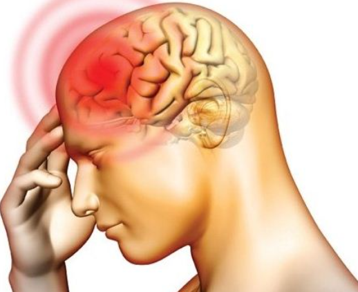 뇌졸중의 주요 증상