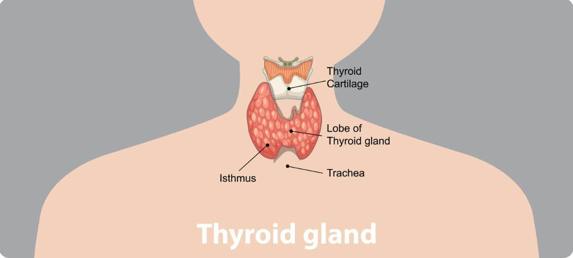 갑상선 기능 저하증 비교 분석