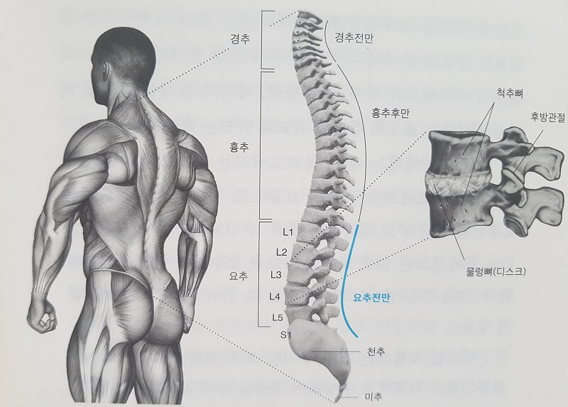 요추전만에 관해 설명