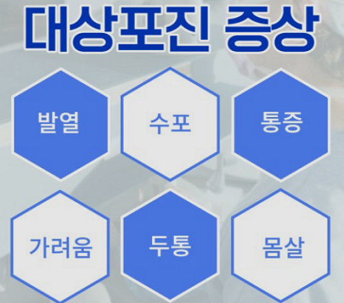 대상포진 증상