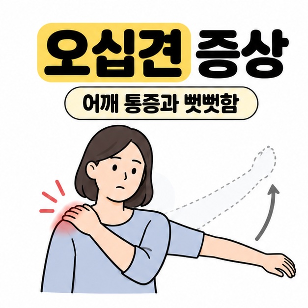 오십견 증상 제목과 어깨를 짚은 사람, 팔의 움직임 표시로 어깨 통증과 뻣뻣함을 설명한 썸네일