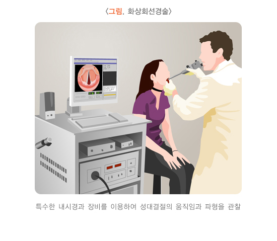 성대결절 성대폴립